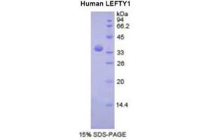 SDS-PAGE (SDS) image for Left-Right Determination Factor 1 (LEFTY1) (AA 78-361) protein (His tag) (ABIN2121538)