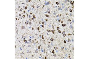 Immunohistochemistry of paraffin-embedded mouse brain using MMP9 antibody (ABIN4904400) at dilution of 1:100 (40x lens).
