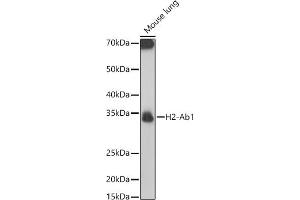 Western blot analysis of extracts of Mouse lung, using H2-Ab1 antibody (ABIN7267665) at 1:1000 dilution. (H2-AB1 antibody)