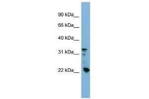 Western Blot showing Crystallin Beta B3 antibody used at a concentration of 1-2 ug/ml to detect its target protein. (CRYBB3 antibody  (Middle Region))