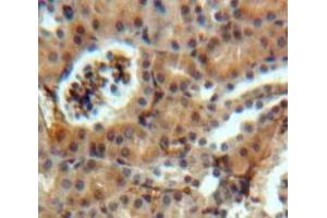 Used in DAB staining on fromalin fixed paraffin-embedded Kidney tissue (SOSTDC1 antibody  (AA 24-206))