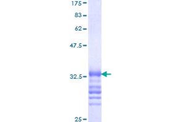 HOXA3 Protein (AA 1-77) (GST tag)