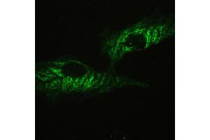 IHC analysis of ATX2 using anti-ATX2 antibody . (Ataxin 2 antibody  (C-Term))