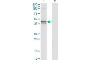 Western Blot analysis of FAS expression in transfected 293T cell line by FAS monoclonal antibody (M11), clone 1B6. (FAS antibody  (AA 1-335))