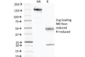 SDS-PAGE Analysis of Purified, BSA-Free p57 Antibody (clone KP10). (P57 antibody)