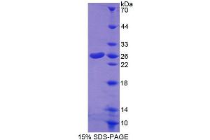 SDS-PAGE (SDS) image for Carnitine O-Octanoyltransferase (CROT) (AA 410-612) protein (His tag) (ABIN4989230)