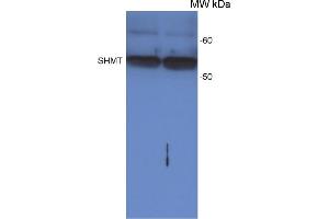 Western Blot detection of SHMT protein in Arabidopsis thaliana leaf extract, loaded on a leaf disc area.