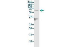 IGSF8 polyclonal antibody (A01). (IGSF8 antibody  (AA 220-322))