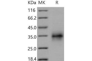 Western Blotting (WB) image for Tumor Necrosis Factor Receptor Superfamily, Member 1A (TNFRSF1A) (Active) protein (His tag) (ABIN7320255) (TNFRSF1A Protein (His tag))
