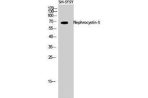 Western Blotting (WB) image for anti-IQ Motif Containing B1 (IQCB1) (Internal Region) antibody (ABIN3185822)