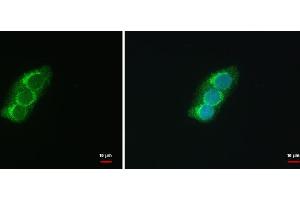 ICC/IF Image SEC13L1 antibody [N1C3] detects SEC13L1 protein at COP II vesicles by immunofluorescent analysis. (SEC13 antibody  (Center))