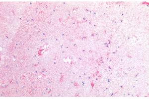 Immunohistochemistry staining of human cortex (paraffin-embedded sections) with anti-CD142 (HTF-1), 10 μg/mL. (Tissue factor antibody)