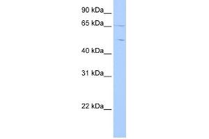 WB Suggested Anti-CPNE4 Antibody Titration: 0. (Copine IV antibody  (C-Term))