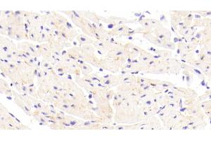 Detection of CDHH in Human Cardiac Muscle Tissue using Polyclonal Antibody to Cadherin, Heart (CDHH) (Cadherin 13 antibody  (AA 23-133))