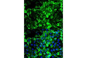 Immunofluorescence analysis of HeLa cells using TPM1 antibody (ABIN2989338).