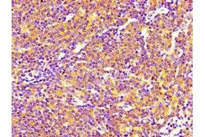 Immunohistochemistry of paraffin-embedded human lymph node tissue using ABIN7169699 at dilution of 1:100 (SIPA1 antibody  (AA 759-927))