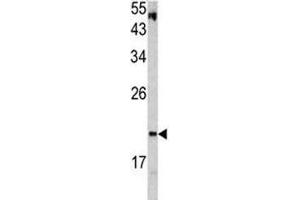 Western blot analysis of VHL antibody and HepG2 lysate. (VHL antibody  (AA 181-210))