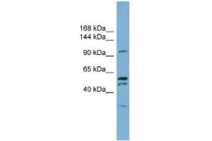 WB Suggested Anti-ANO6 Antibody Titration:  0. (Anoctamin 6 antibody  (C-Term))