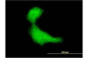 Image no. 3 for anti-DnaJ (Hsp40) Homolog, Subfamily B, Member 2 (DNAJB2) (AA 216-325) antibody (ABIN598751) (DNAJB2 antibody  (AA 216-325))