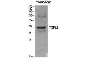 Western Blotting (WB) image for anti-Transforming Growth Factor, beta 2 (TGFB2) (C-Term) antibody (ABIN3177703) (TGFB2 antibody  (C-Term))