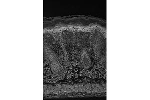 Immunohistochemistry (IHC) image for anti-Hypoxia Inducible Factor 1, alpha Subunit (Basic Helix-Loop-Helix Transcription Factor) (HIF1A) (Internal Region) antibody (ABIN6656065)