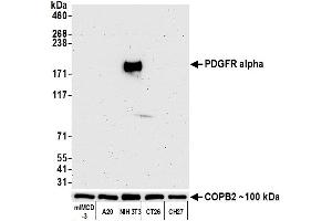Western Blotting (WB) image for anti-Platelet Derived Growth Factor Receptor alpha (PDGFRA) (AA 24-525) antibody (ABIN7453344)