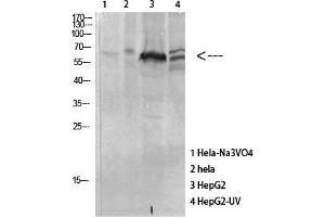 Western Blot (WB) analysis of specific cells using Antibody diluted at 1:1000. (MAPKAP Kinase 5 antibody  (pThr182))