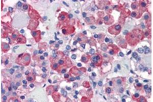 Anterior pituitary: Formalin-Fixed, Paraffin-Embedded (FFPE) (Growth Hormone 1 antibody)