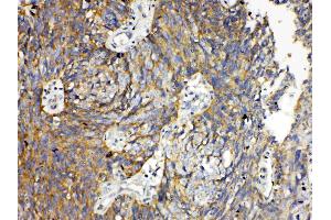 Immunohistochemistry (IHC) image for anti-Tumor Necrosis Factor Receptor Superfamily, Member 11a, NFKB Activator (TNFRSF11A) (AA 235-262), (Middle Region) antibody (ABIN5518884)