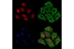 ABIN7094868 and ABIN7098920 staining Hela cells by IF/ICC. (UBASH3B antibody  (Internal Region))