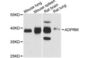 Western blot analysis of extracts of various cell lines, using ADPRM antibody. (ADPRM antibody)