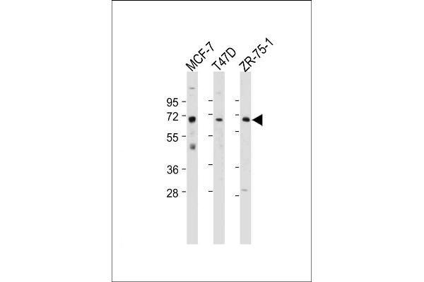 Estrogen Receptor alpha antibody  (AA 246-273)