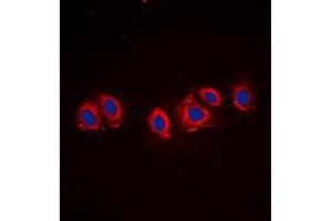 Immunofluorescent analysis of PDGFR alpha staining in NIH3T3 cells. (PDGFRA antibody  (C-Term))