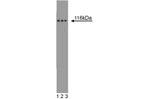 Western blot analysis of FAK on a A431 cell lysate (Human epithelial carcinoma, ATCC CRL-1555).