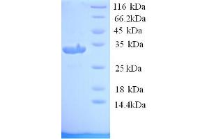 SDS-PAGE (SDS) image for Plasminogen Activator, Urokinase (PLAU) (AA 25-299) protein (His tag) (ABIN5713738) (PLAU Protein (AA 25-299) (His tag))
