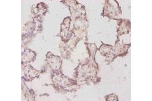 Immunohistochemistry of paraffin-embedded human placenta tissue using ABIN7177935 at dilution of 1:20 (TPT1 antibody  (AA 1-172))