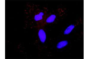 Proximity Ligation Analysis of protein-protein interactions between MAP3K5 and APP. (ASK1 antibody  (AA 1-1374))