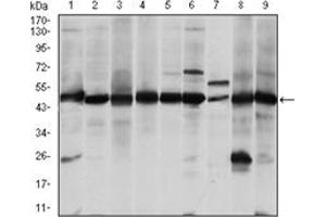 Western Blotting (WB) image for anti-Argininosuccinate Synthase 1 (ASS1) antibody (ABIN1105454) (ASS1 antibody)