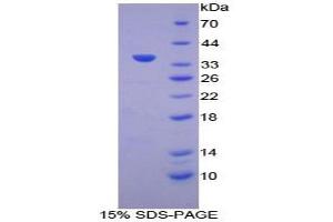 SDS-PAGE analysis of Human ATP6AP2 Protein.