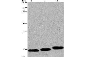 Western blot analysis of Mouse skeletal muscle, heart and bladder tissue, using MYL12B Polyclonal Antibody at dilution of 1:550