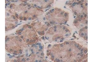 Detection of PDIA4 in Human Stomach Tissue using Polyclonal Antibody to Protein Disulfide Isomerase A4 (PDIA4) (PDIA4 antibody  (AA 505-636))