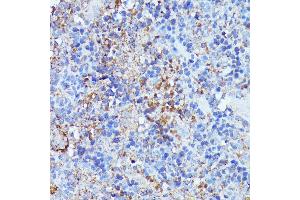 Immunohistochemistry of paraffin-embedded rat spleen using Septin 1 antibody (ABIN7270202) at dilution of 1:100 (40x lens). (Septin 1 antibody  (AA 270-370))