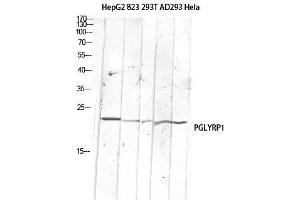 Western Blot (WB) analysis of HepG2 823-AV 293T AD293 HeLa lysis using PGLYRP1 antibody.
