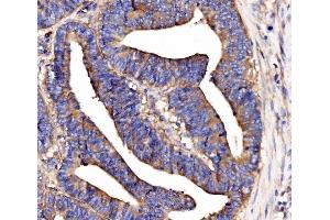 IHC analysis of SCRN1 using anti-SCRN1 antibody (ABIN7602923). (Secernin 1 antibody  (C-Term))