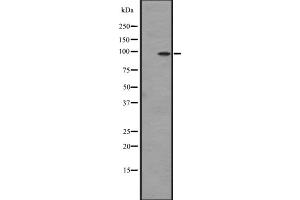Western blot analysis of DDR2 expression in Hela cell lysate,The lane on the left is treated with the antigen-specific peptide.