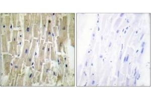 Immunohistochemistry analysis of paraffin-embedded human heart tissue, using PDLIM1 Antibody. (PDLIM1 antibody  (AA 61-110))