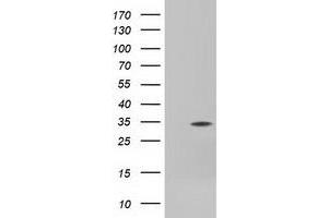 Western Blotting (WB) image for anti-Four and A Half LIM Domains 1 (FHL1) antibody (ABIN1500977)