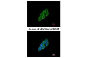 ICC/IF Image Immunofluorescence analysis of methanol-fixed A431, using LTBP4, antibody at 1:200 dilution.