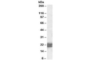 Western blot testing of human testis lysate with NPC2 antibody at 0. (NPC2 antibody)