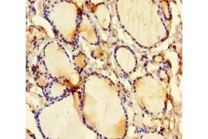 Immunohistochemistry of paraffin-embedded human thyroid tissue using ABIN7153665 at dilution of 1:100 (Non-Syndromic Hearing Impairment Protein 5 (GSDME) (AA 1-496) antibody)